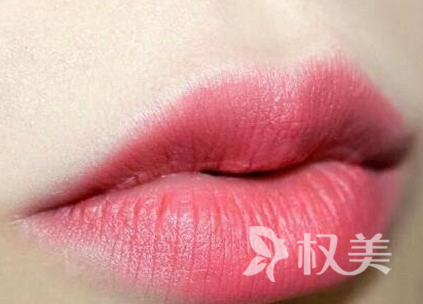 洛阳王城整形医院漂唇一般需要多久恢复正常 能保持多久