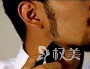 厦门植发医院价格表 鬓角种植多少钱