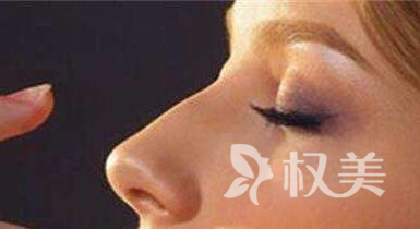 杭州静港整形医院硅胶隆鼻术有什么优势 可以维持多长时间