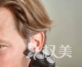 青岛海伦做鬓角植发 提升你的魅力值