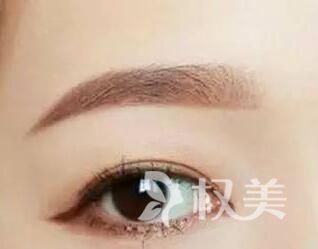 眉毛变浓的方法有哪些 杭州雍禾植发做眉毛种植效果自然吗