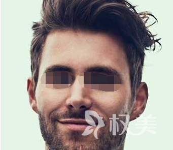 发际线种植贵吗 广州弘基植发医院发际线种植优势