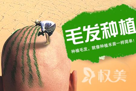 发际线太高怎么办 解决方法发际线种植