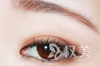 郑州美莱植发医院植眉好吗 让你素颜更动人