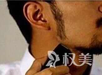 植发医院如何选择 昆明新生做胡鬓角植怎么样
