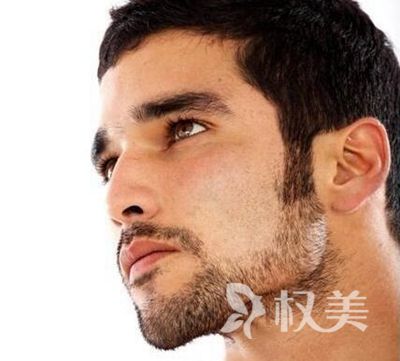 温州科发源种鬓角多少钱 效果自然吗