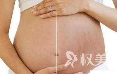 去妊娠纹扬州哪家医院好 激光祛妊娠纹多少钱