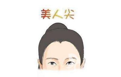 柳州贞韩植发医院地址 种植美人尖贵吗多久见效
