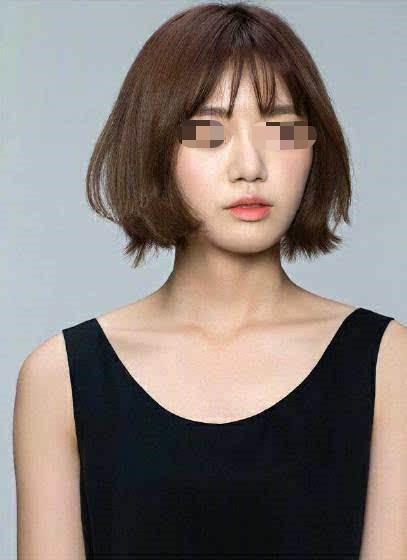 深圳希思整形医院植发整形科发际线种植效果怎么样