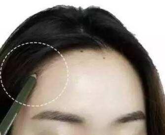 大连整发际线哪好 价格贵不贵