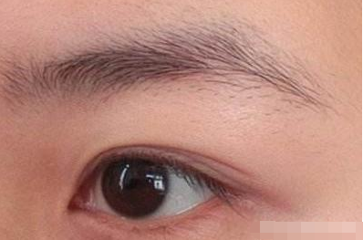 石家庄植发医院做眉毛种植多少钱 怎么设计手术方案