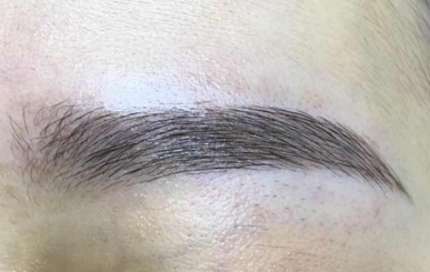 种植的眉毛能维持多久 郑州美莱植发医疗整形医院怎么样