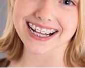 儿童牙齿矫正时机 宁波美奥口腔整形医院矫正牙齿费用