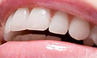 上海博厚口腔医院如何做牙齿修复 牙齿修复适合什么症状