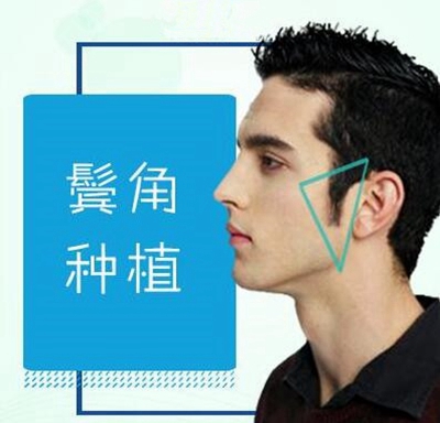 成都植发医院哪家好 鬓角种植效果怎么样