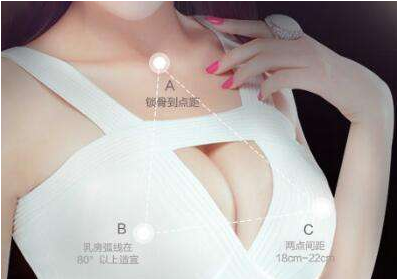 杭州藝星整形醫院【胸部整形】硅膠隆胸 做女人“挺”美