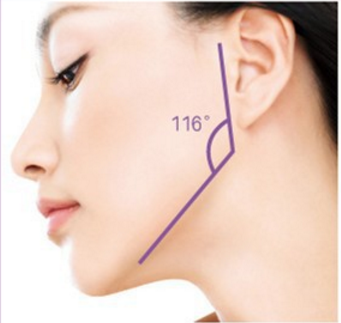 脸部整形手术有哪些项目 广州下颌角截骨有风险吗