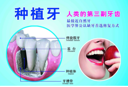 深圳弘和口腔种植牙齿需要多少钱 有哪些优点