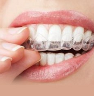杭州牙齿矫正哪种方法好 隐形牙齿矫正让您牙齿美美的
