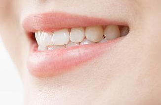 郑州贝尔口腔门诊部牙齿正畸价位 隐形牙套能矫正牙齿吗