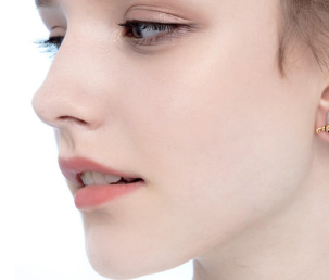 自体隆鼻价格一般是多少 自体隆鼻过后多久可以恢复