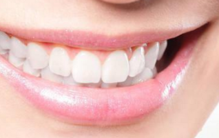 南京月牙儿口腔诊所成人牙齿矫正的效果 要多少钱