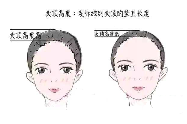 南京建国领秀植发医院发际线种植 让你脸型更漂亮