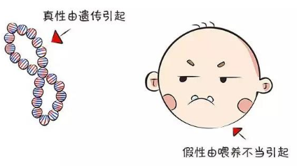 地包天怎么治疗 上海做地包天矫正有年龄限制吗