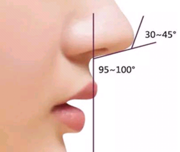 鼻小柱延长是让鼻子变长吗 整形专家来科普鼻小柱知识