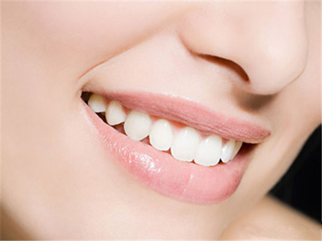 西安联邦口腔医院牙齿矫正 拯救你的笑容 笑起来更甜