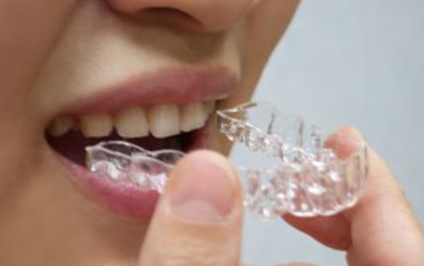 北京斯迈尔口腔门诊部做牙齿矫正需要多长时间 得多少钱