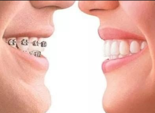 西安口腔医院排名 西安联邦口腔医院牙齿矫正报价