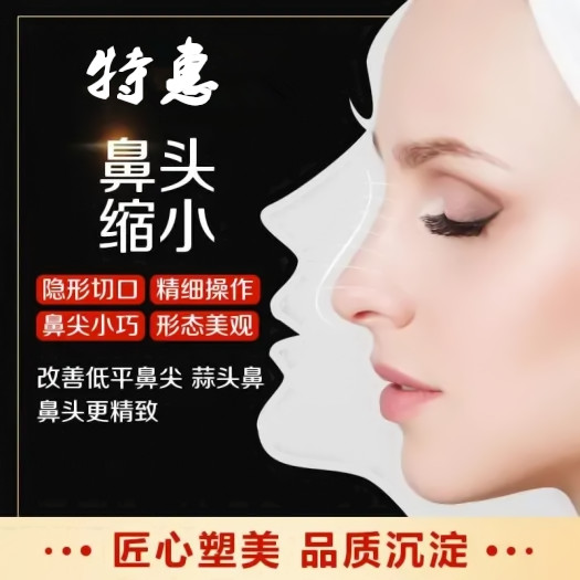 郑州东方女子【鼻尖整形】精致的鼻尖塑造更精致的面容