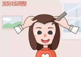 杭州虹桥医院新生植发毛发种植整形科发际线种植贵吗