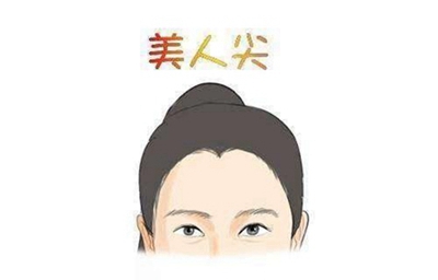 南京韩辰植发医院种美人尖要多少钱 具体价格因人而异