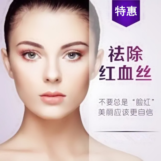 北京欧芭丽格整形医院激光祛除脸部红血丝 拯救敏感肌肤