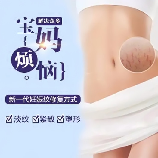 深圳广和整形医院激光妊娠纹修复多少钱 还原光滑女肌 