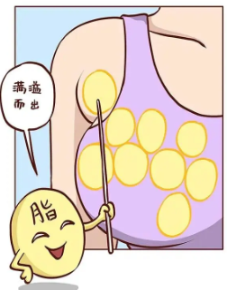 深圳北大医院胡华新吸脂去副乳优势 价格表一览