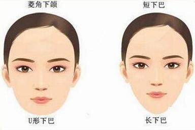 南京磨骨整形手术多少钱 瘦脸让你美得更精致