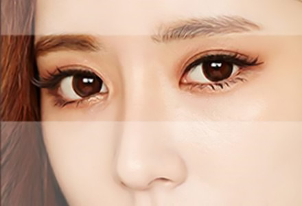 广州韩妃整形医院李光琴专家做双眼皮 展现你靓丽的双眸