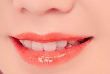 漂唇术可以实现的唇形有哪些 具体步骤是怎么样的