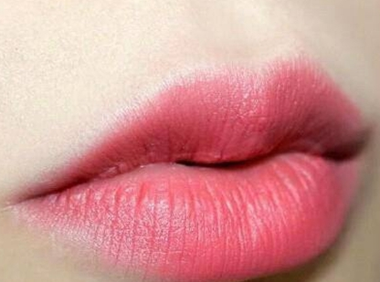 嘴唇的美感怎么样提升 纹唇手术具体的优势是什么