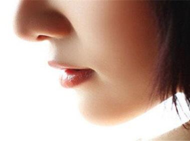 膨体隆鼻的材料有哪些优势 膨体隆鼻恢复期长吗