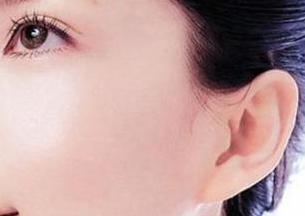 副耳切除整形术 改变先天缺陷 让耳朵绽放光彩