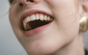 牙齿矫正存在哪些优势 牙齿矫正的常见方法有哪些