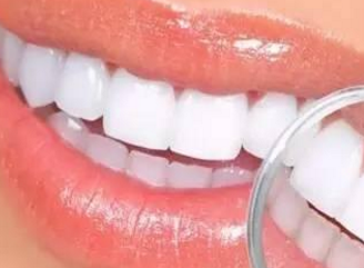 牙齿种植是什么 做牙齿种植有怎么样的优势 需要多久