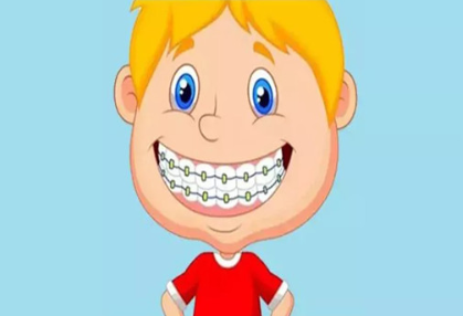 牙齿矫正可以改善脸型吗 贵阳丽都整形矫正牙齿 绽放笑容