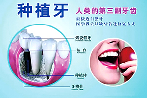 杭州口腔整形哪家好 美莱口腔做种植牙靠谱吗 多少钱