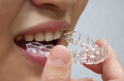 上海松丰牙科整形地包天手术整形费用多少 方法有几种