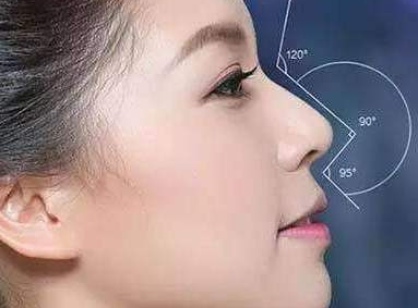 自贡西婵整形医院鼻头缩小术 鼻子更精致有立体感